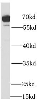 SDHA Rabbit Polyclonal Antibody