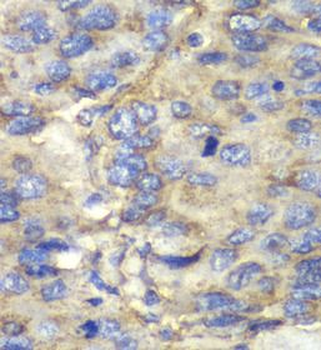 SDHA Rabbit Polyclonal Antibody