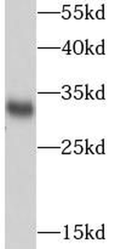 SDHB Rabbit Polyclonal Antibody