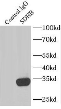 SDHB Rabbit Polyclonal Antibody