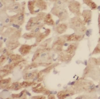 SDHB Rabbit Polyclonal Antibody