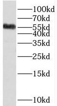 SDSL Rabbit Polyclonal Antibody