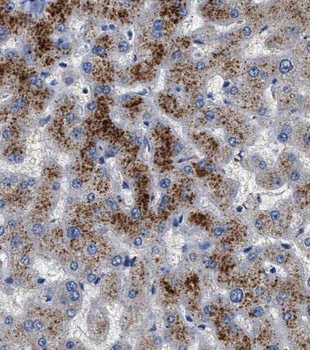 SDSL Rabbit Polyclonal Antibody