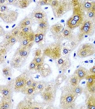 SECISBP2 Rabbit Polyclonal Antibody