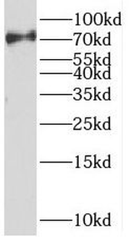 SENP1 Rabbit Polyclonal Antibody