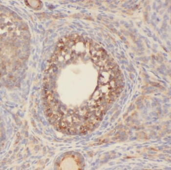 SENP1 Rabbit Polyclonal Antibody