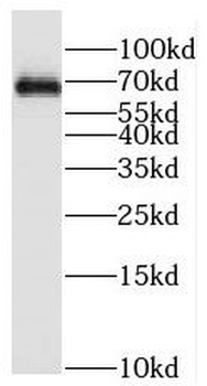 SENP3 Rabbit Polyclonal Antibody