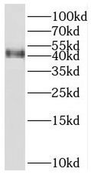 SERPINB6 Rabbit Polyclonal Antibody