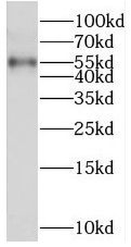 SERPING1 Rabbit Polyclonal Antibody