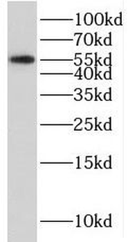 SERPINI2 Rabbit Polyclonal Antibody