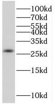 APCS Rabbit Polyclonal Antibody