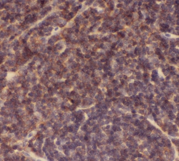 APCS Rabbit Polyclonal Antibody