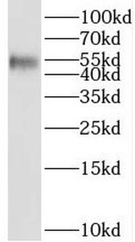 SETD6 Antibody