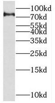 SETMAR Rabbit Polyclonal Antibody