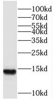 SF3B6 Rabbit Polyclonal Antibody