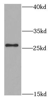 SFRP2 Antibody
