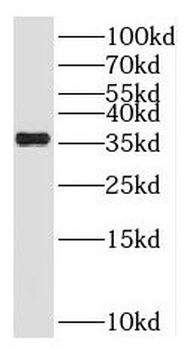 SFXN3 Rabbit Polyclonal Antibody