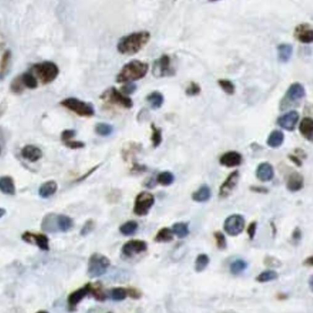 SFXN3 Rabbit Polyclonal Antibody