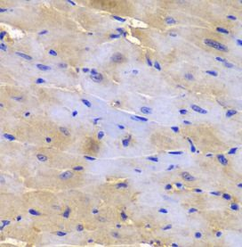 SGCE Rabbit Polyclonal Antibody