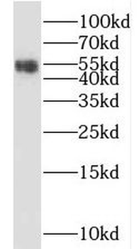 SGMS1 Rabbit Polyclonal Antibody