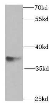 SGTA Antibody
