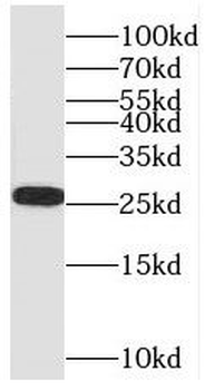 SH3BGR Rabbit Polyclonal Antibody