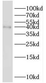 SH3GL2 Antibody