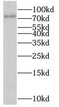 SHKBP1 Rabbit Polyclonal Antibody