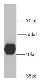 SHMT1 Rabbit Polyclonal Antibody