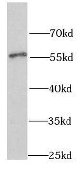 SHMT2 Rabbit Polyclonal Antibody