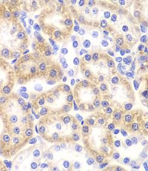 SHMT2 Rabbit Polyclonal Antibody