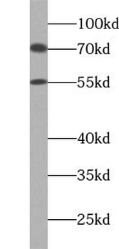 PTPN11 Rabbit Polyclonal Antibody