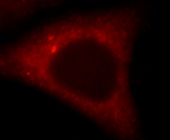 PTPN11 Rabbit Polyclonal Antibody
