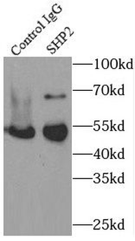 PTPN11 Rabbit Polyclonal Antibody
