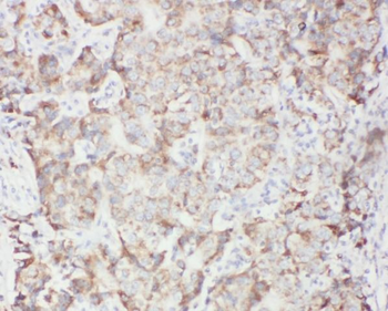 PTPN11 Rabbit Polyclonal Antibody