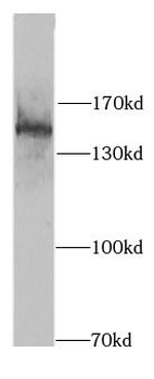 SIN3A Rabbit Polyclonal Antibody