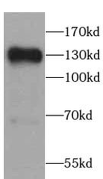 SIRT1 Rabbit Polyclonal Antibody