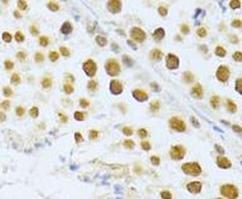 SIRT1 Rabbit Polyclonal Antibody