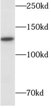 SIRT1 Mouse Monoclonal Antibody