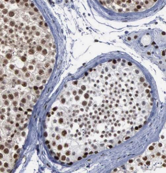 SIRT1 Mouse Monoclonal Antibody