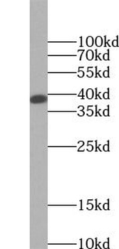 SIRT2 Rabbit Polyclonal Antibody