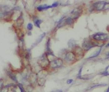 SIRT2 Rabbit Polyclonal Antibody