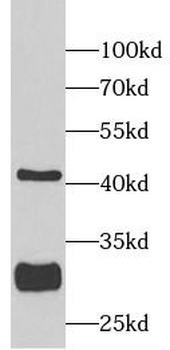SIRT3 Rabbit Polyclonal Antibody