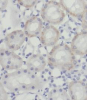 SIRT3 Rabbit Polyclonal Antibody