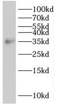 SIRT4 Rabbit Polyclonal Antibody
