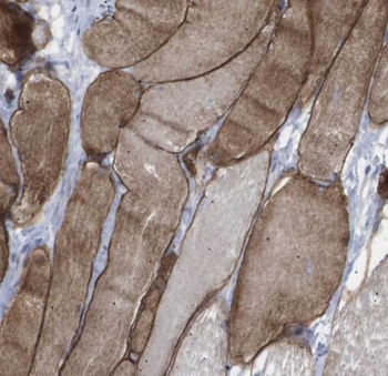 SIRT4 Rabbit Polyclonal Antibody