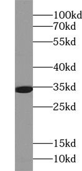 SIRT5 Rabbit Polyclonal Antibody