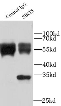 SIRT5 Rabbit Polyclonal Antibody