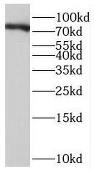 SKIL Rabbit Polyclonal Antibody