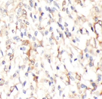 SLC11A2 Antibody